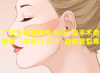 广汉华西唇裂修 🐋 复手术费用解析「华西口 🐝 腔做唇裂哪个医生做得好」